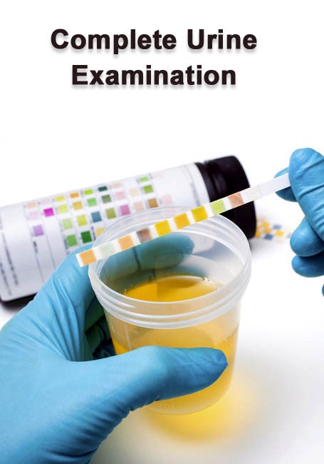 Complete Urine Examination