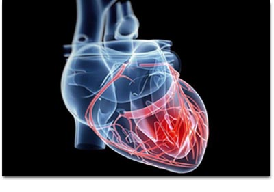 Lipid Profile at Mirage lab
